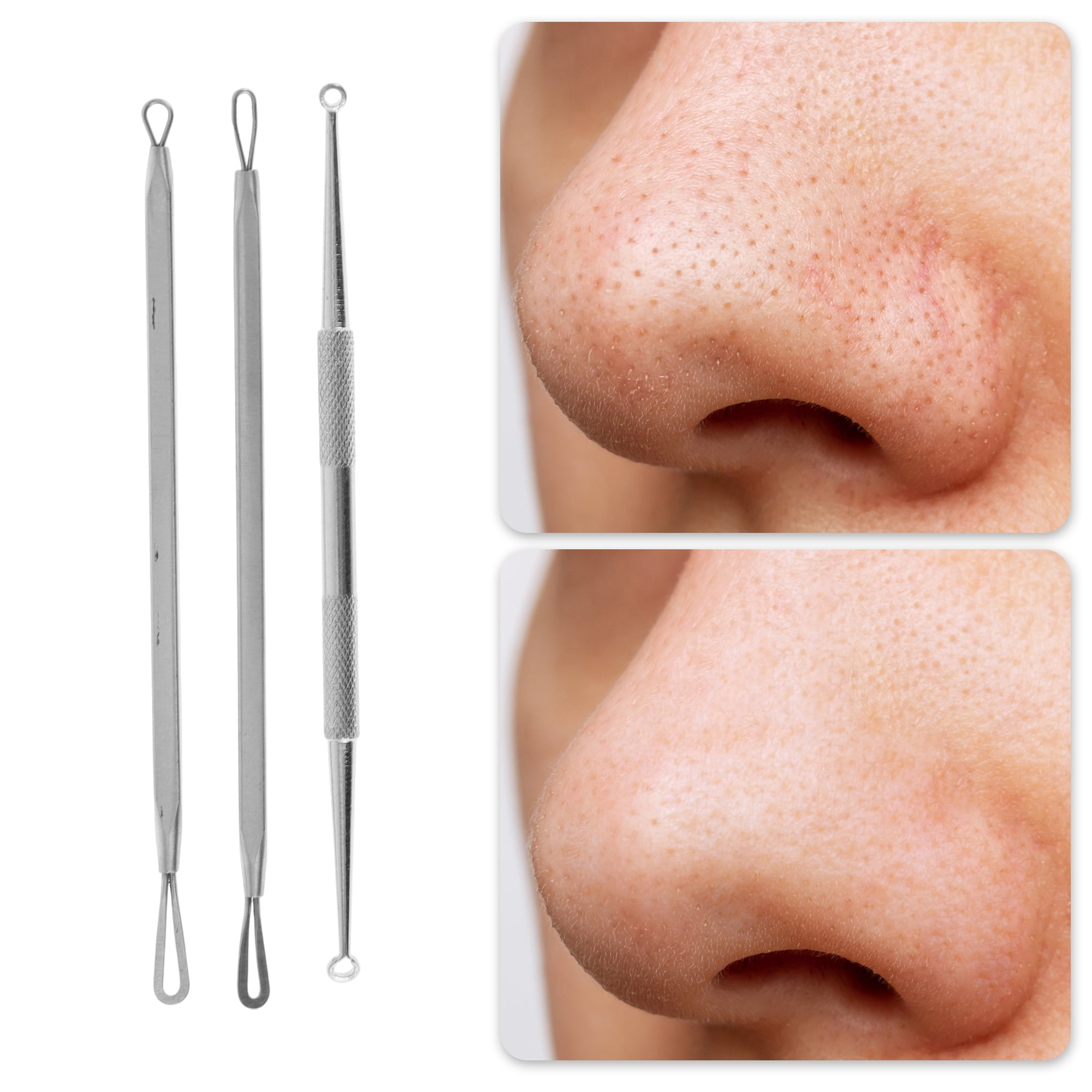 Kit Profissional Extrator de C - Beauty & Makeup Katia Di Paola Palermo avaliação e preço